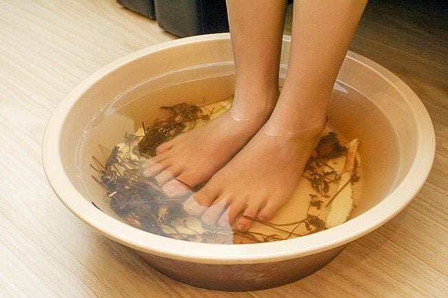 Suy giãn tĩnh mạch chân và những quan niệm sai lầm